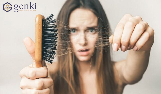 Biến mái tóc thưa thớt thành “ đầy vun” bằng các cách trị rụng tóc đơn giản