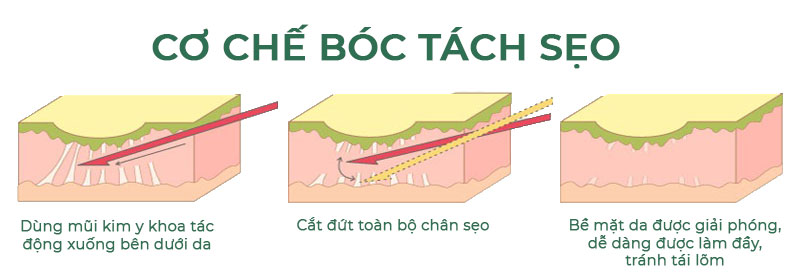 boc-tach-seo