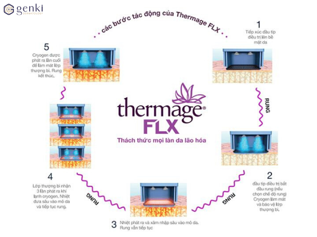 Công nghệ nâng cơ mặt Thermage FLX