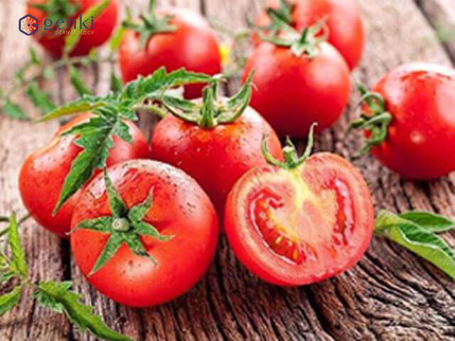 Cà chua có công dụng điều trị sẹo lõm hiệu quả