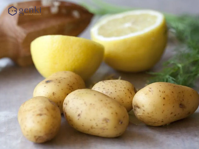 cách trị nám da mặt từ khoai tây kết hợp với chanh
