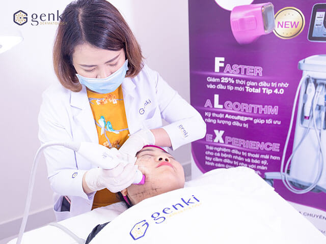 Thermage FLX nâng cơ trẻ hóa khuôn mặt