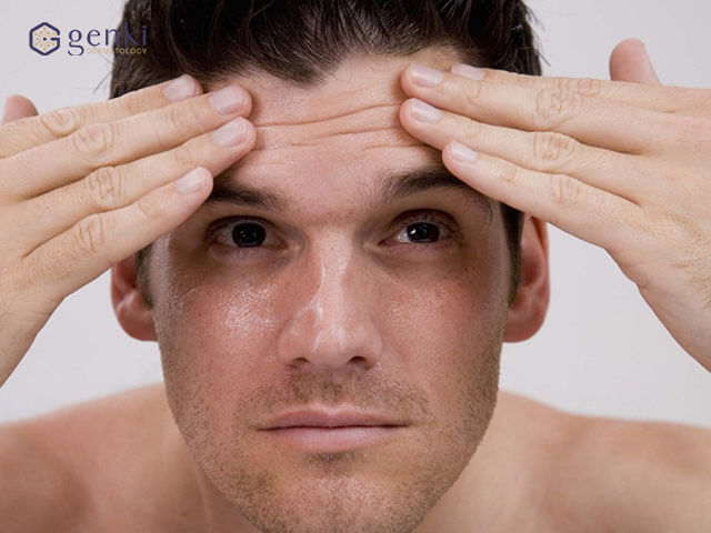 Điểm mặt những dấu hiệu lão hóa da ở nam giới