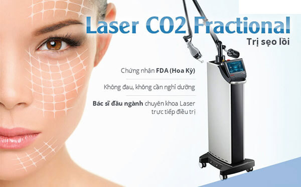 Laser CO2 Fractional điều trị mụn hiệu quả