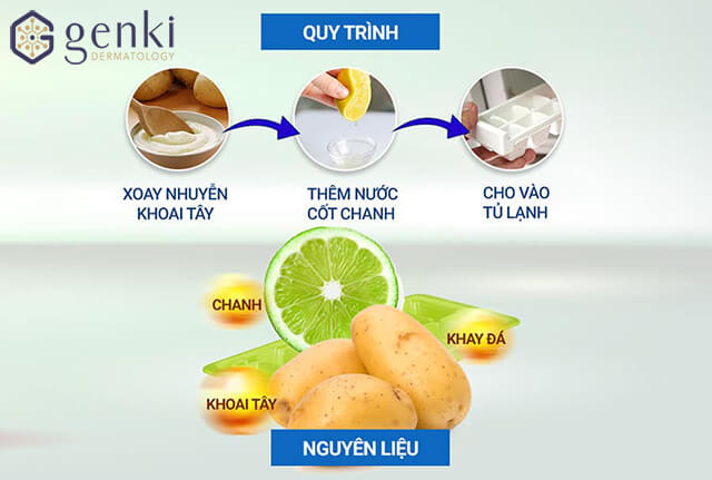 cách trị nám da mặt bằng chanh và khoai tây