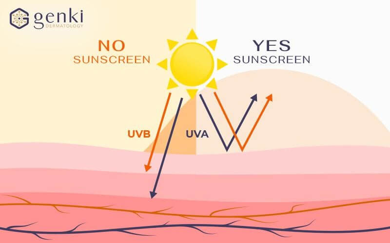 Sử dụng và thoa kem chống nắng đúng cách giúp chống tia UV hiệu quả.