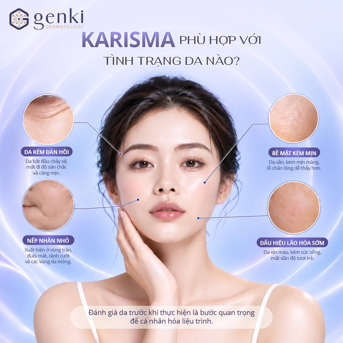 Ai phù hợp và ai nên thận trọng với Karisma?