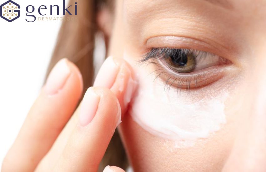 Vùng da quanh mắt thường mỏng và nhạy cảm hơn các vùng da khác